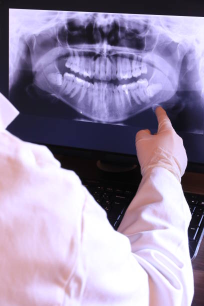 Best Broken or Cracked Tooth Emergency Dentist in Samson, AL
